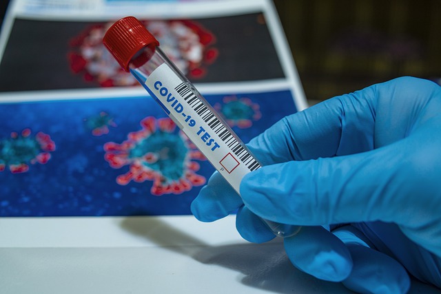 Гумпомощь в виде тест-систем готова оказать Россия Казахстану в борьбе с коронавирусом